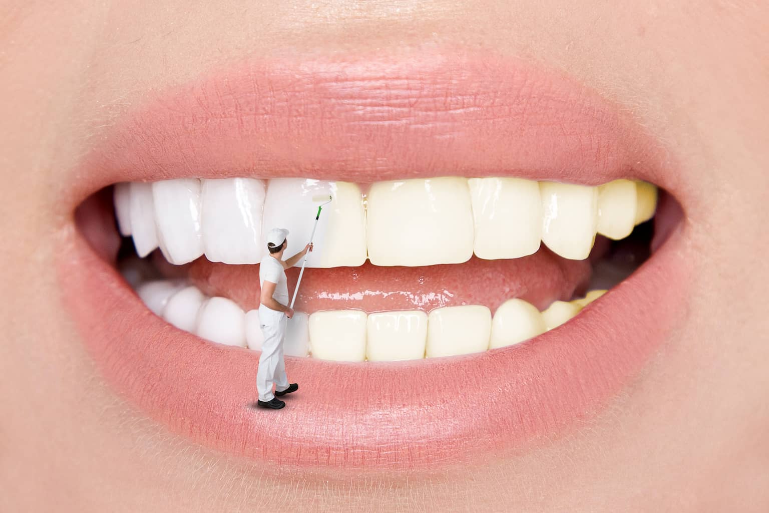 ציפוי ננו-קרמי לשיניים: מה זה אומר ולמי זה מתאים?